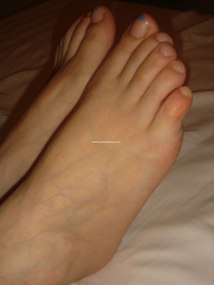 Loading Image